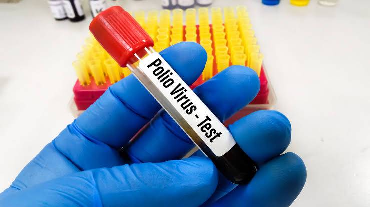 سندھ اور بلوچستان سے پولیو کے دو کیسز سامنے آگئے